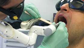 NightLase Snoring and Apnea treatment