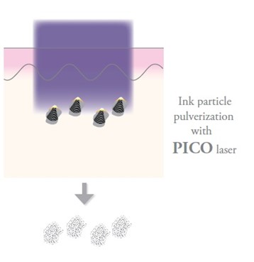PICO fragmentation