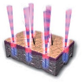 Quanta YouLaser - Mixed Technology